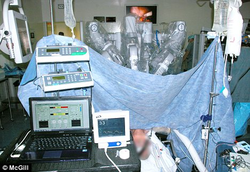 Первая в мире хирургическая операция с участием одних лишь роботов
