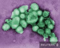 Изображение-негатив, полученное методом трансмиссионной электронной микрографии образца культуры вируса А(H1N1) из слюны пациента, зараженного свиным гриппом